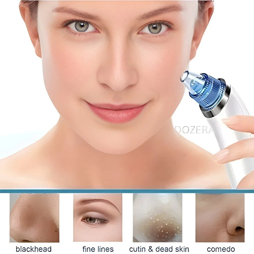 DermaSuction Pore Cleaner — product view 5