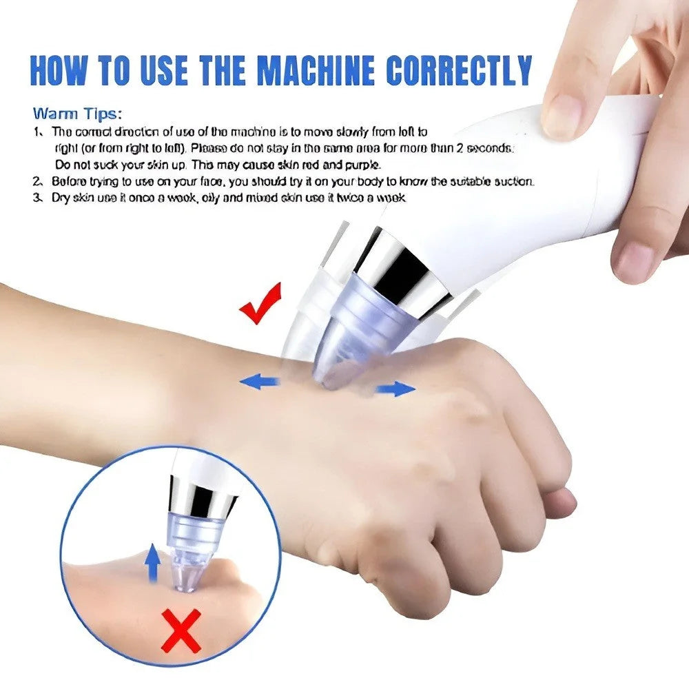 DermaSuction Pore Cleaner — product view 6