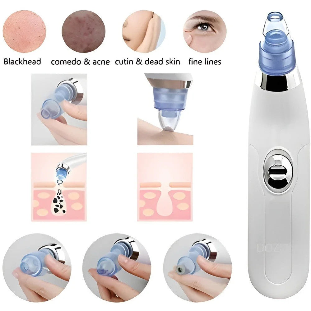 DermaSuction Pore Cleaner — product view 7